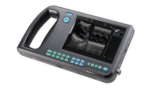 CMS600S Digital PalmSmart Uitrasound Scanner 
